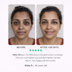 LED eye contour patches – dark circles, puffiness &amp; wrinkles 