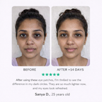 LED eye contour patches – dark circles, puffiness &amp; wrinkles 